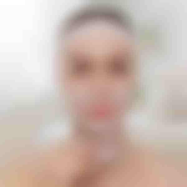 Zvedací pás pro tvarování obličeje | KIMLIFT